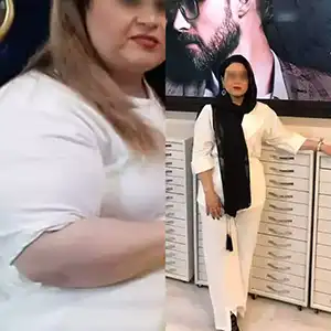 sleeveBeforafter6